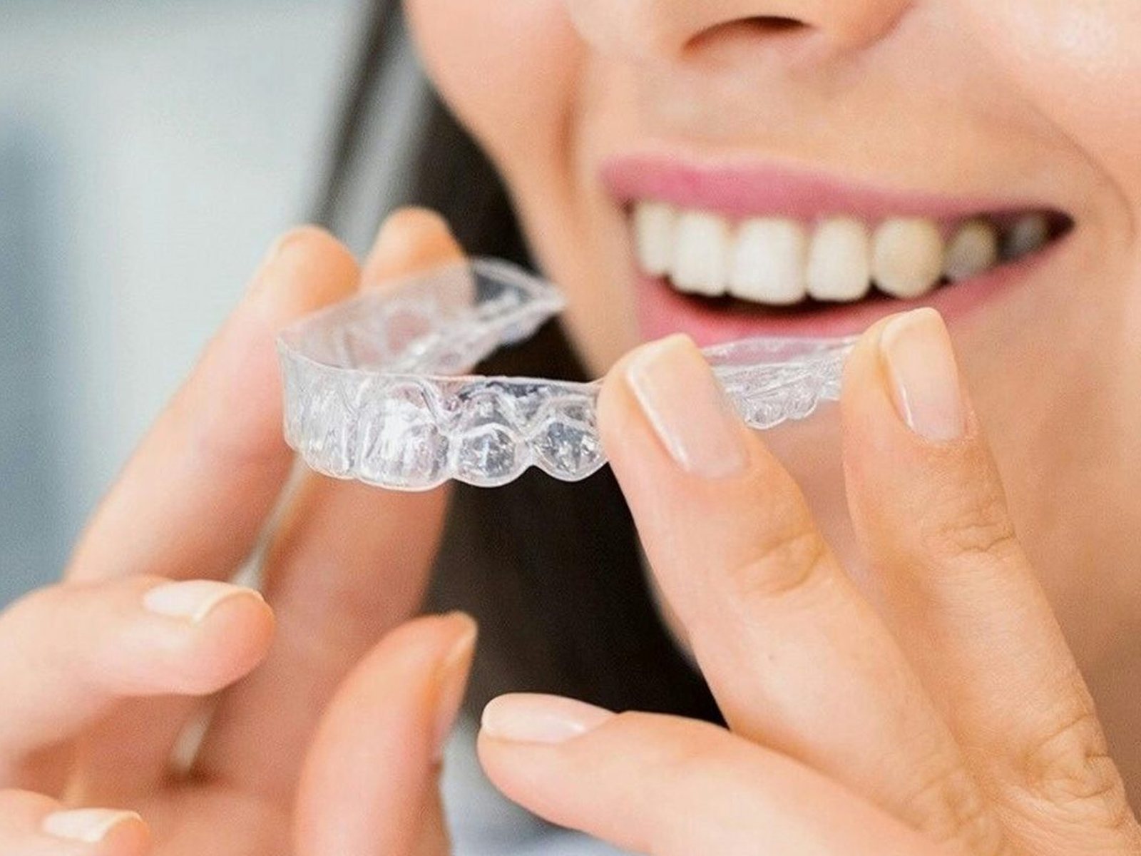 Orthodontics for adults with clear aligners at SmileHouse in Hitzkirch