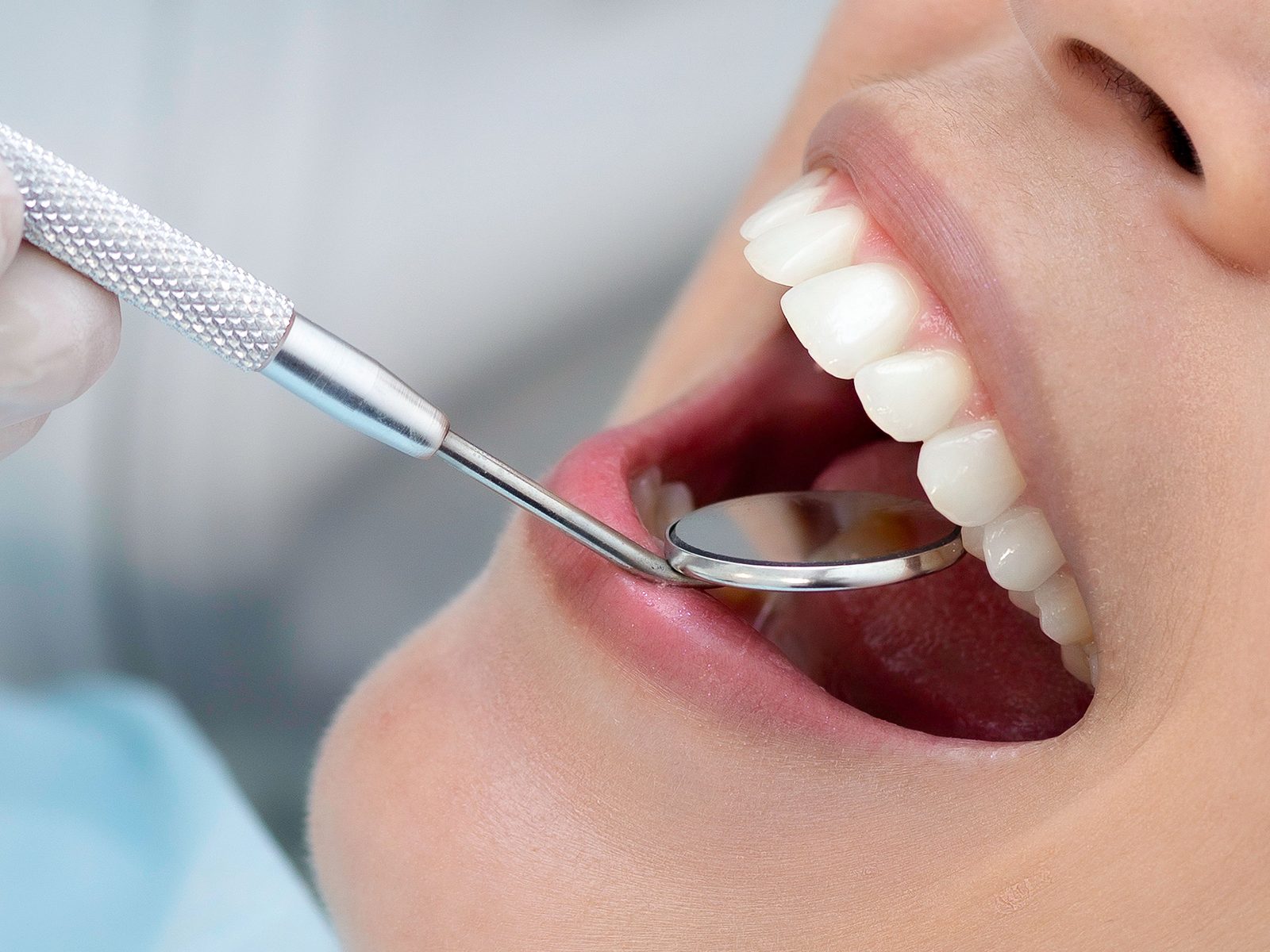 Professional teeth cleaning and prophylaxis at SmileHouse, orthodontics in Hitzkirch